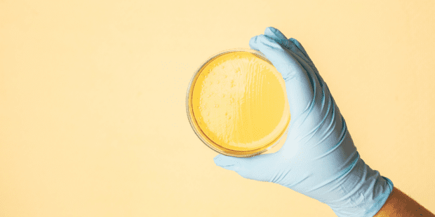 Scientist holding petri dish